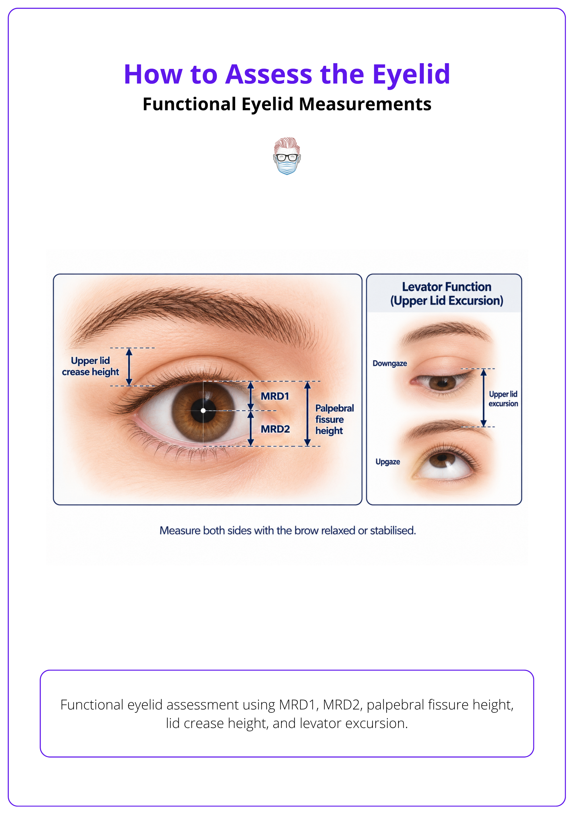 Functional eyelid assessment using MRD1, MRD2, palpebral fissure height, lid crease height, and levator excursion.