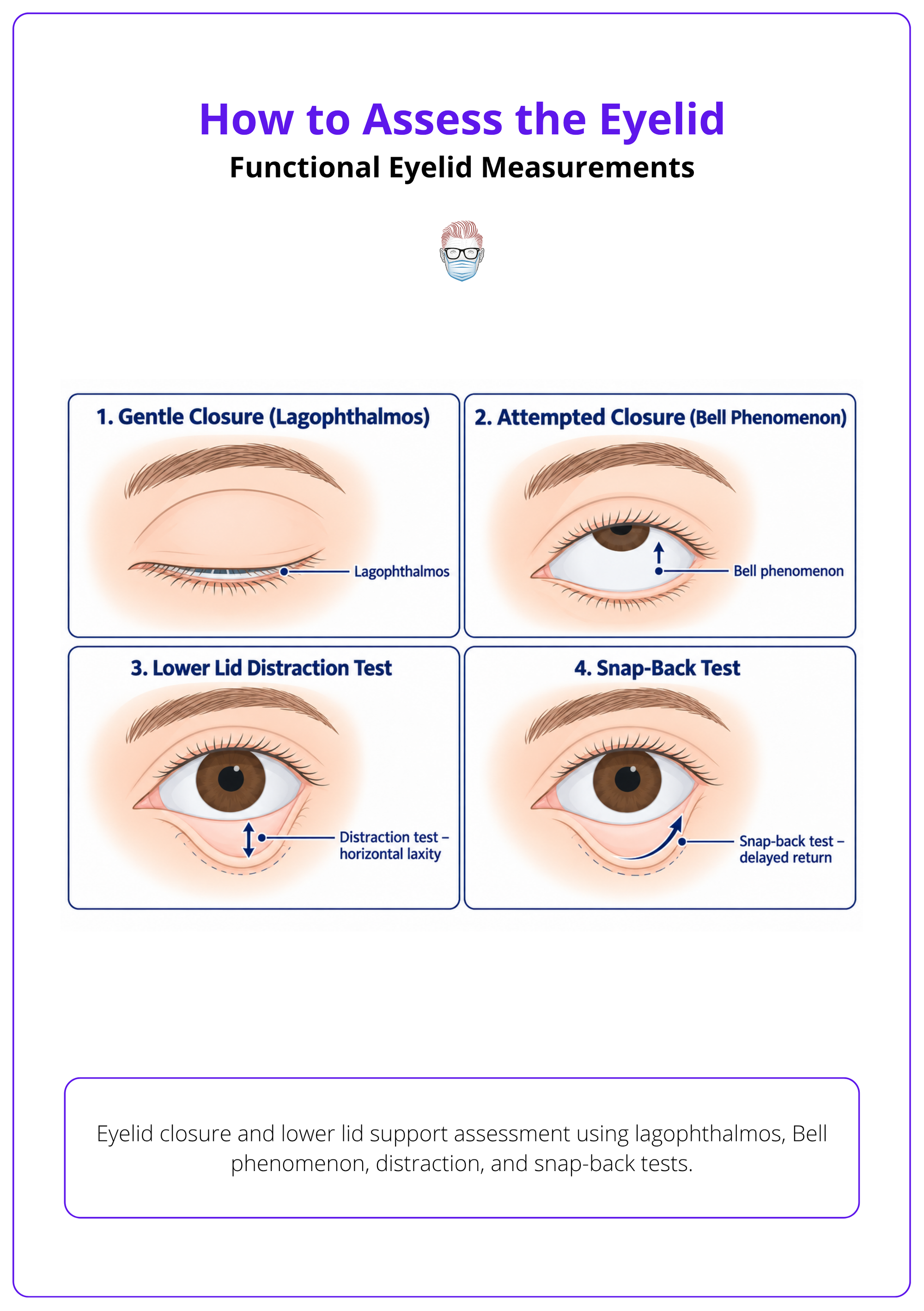 Eyelid closure and lower lid support assessment using lagophthalmos, Bell phenomenon, distraction, and snap-back tests.