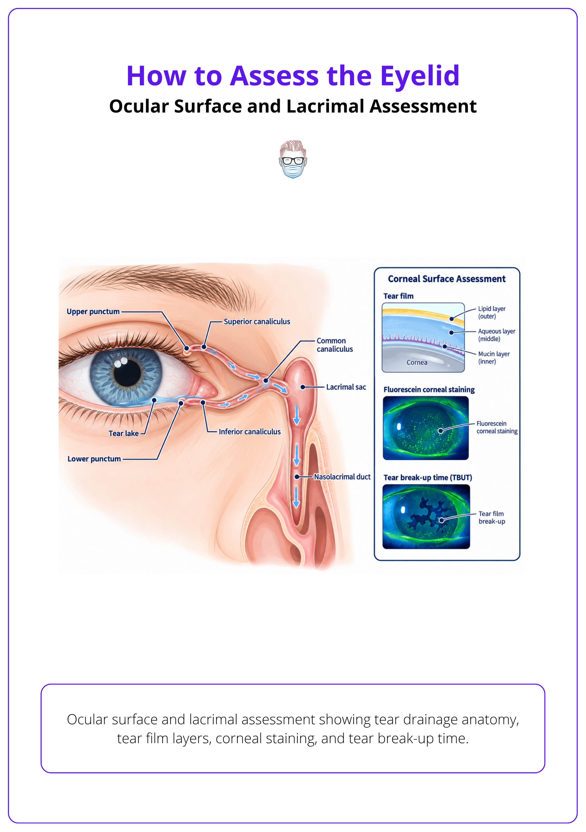 Ocular surface and lacrimal assessment showing tear drainage anatomy, tear film layers, corneal staining, and tear break-up time.