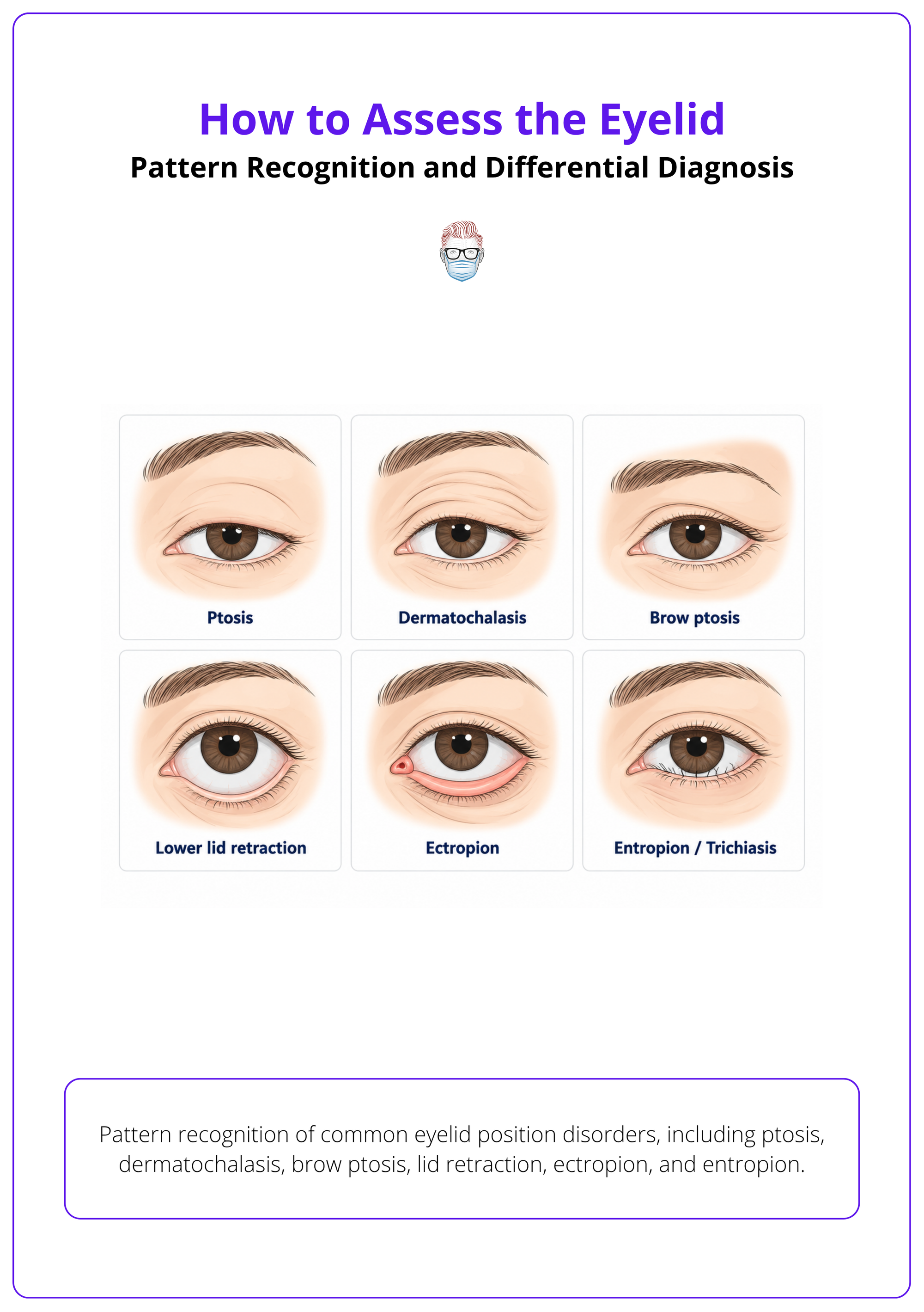 Pattern recognition of common eyelid position disorders, including ptosis, dermatochalasis, brow ptosis, lid retraction, ectropion, and entropion.