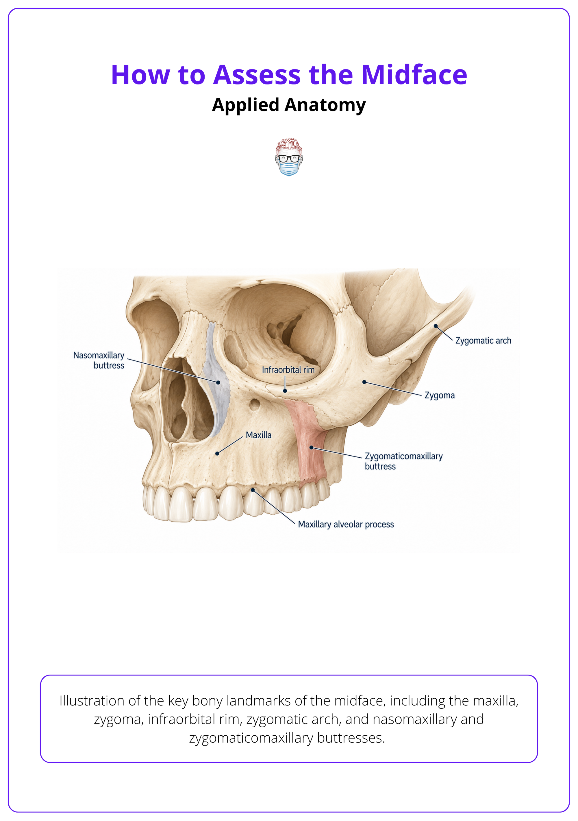 Illustration of the key bony landmarks of the midface, including the maxilla, zygoma, infraorbital rim, zygomatic arch, and nasomaxillary and zygomaticomaxillary buttresses.