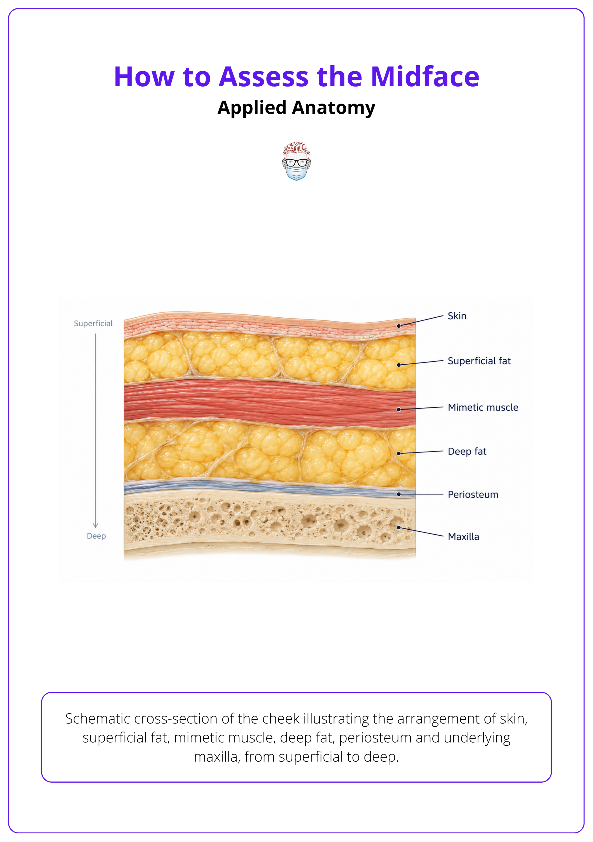Schematic cross-section of the cheek illustrating the arrangement of skin, superficial fat, mimetic muscle, deep fat, periosteum and underlying maxilla, from superficial to deep.