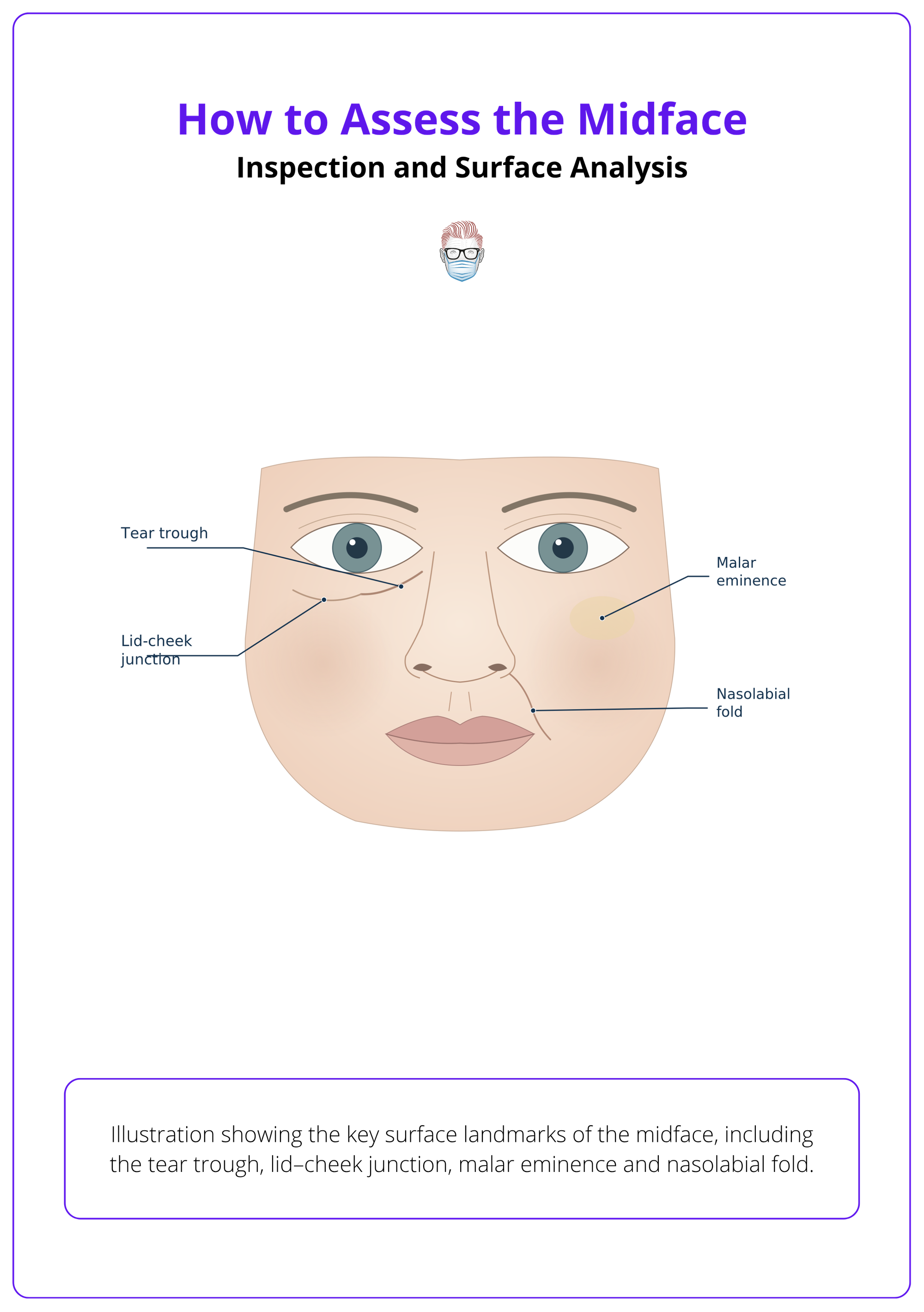 The key surface landmarks of the midface, including the tear trough, lid–cheek junction, malar eminence, and nasolabial fold.