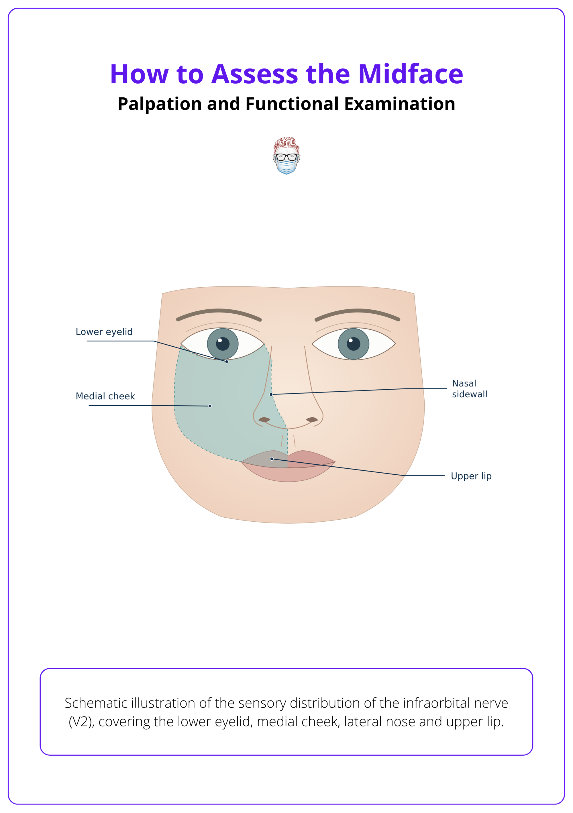 Schematic illustration of the sensory distribution of the infraorbital nerve (V2), covering the lower eyelid, medial cheek, lateral nose and upper lip.