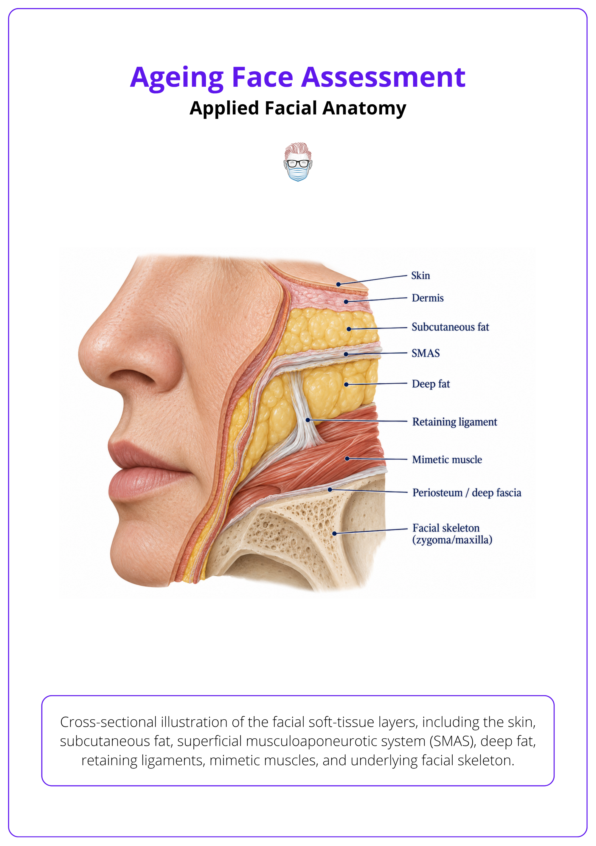 Cross-sectional illustration of the facial soft-tissue layers, including the skin, subcutaneous fat, superficial musculoaponeurotic system (SMAS), deep fat, retaining ligaments, mimetic muscles, and underlying facial skeleton.