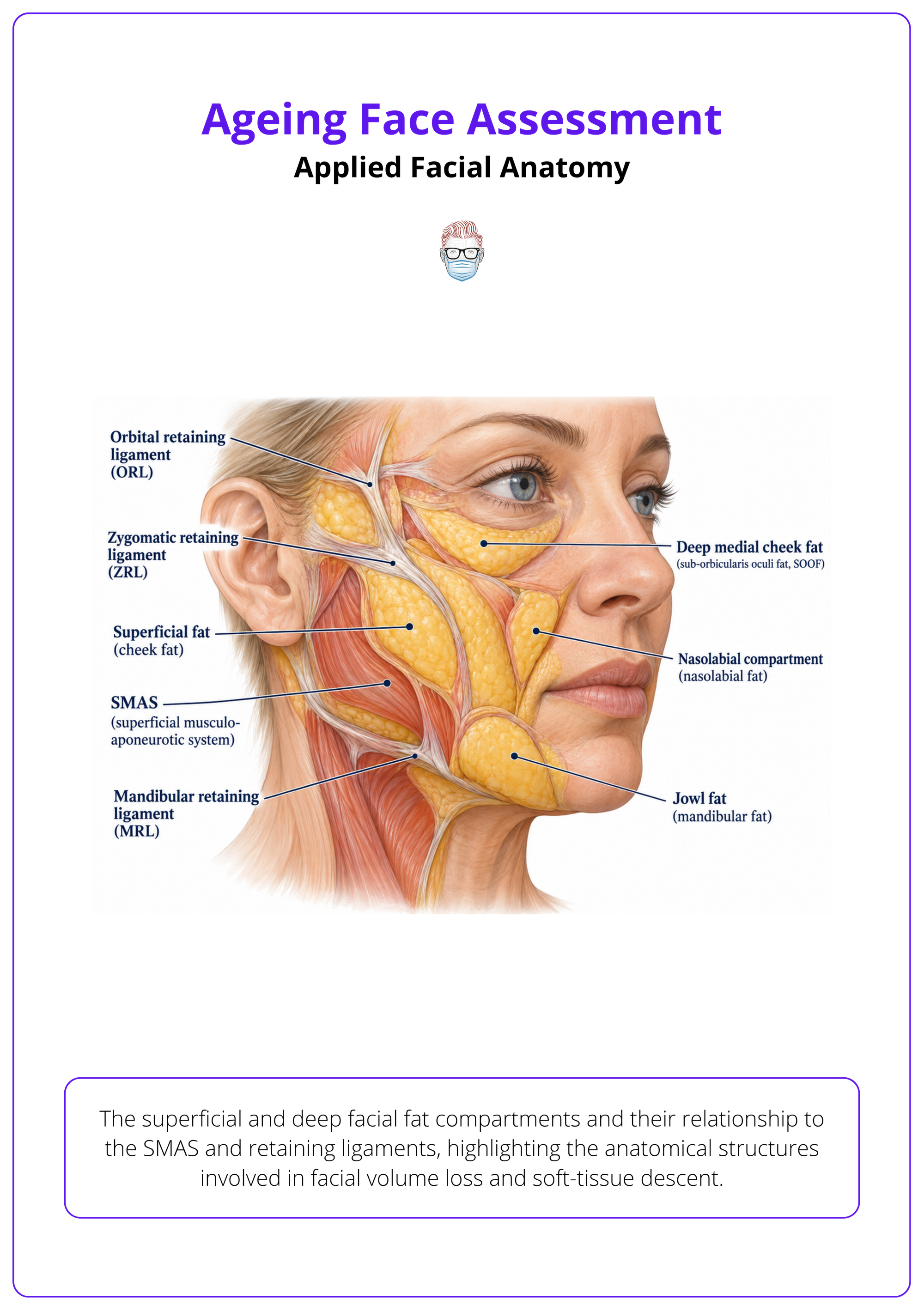 Illustration of the superficial and deep facial fat compartments and their relationship to the SMAS and retaining ligaments, highlighting the anatomical structures involved in facial volume loss and soft-tissue descent.
