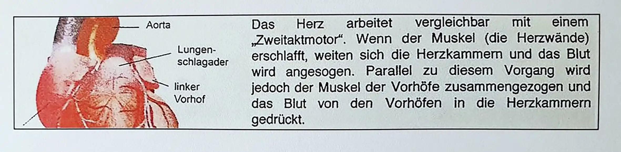 Herzpumpe.webp