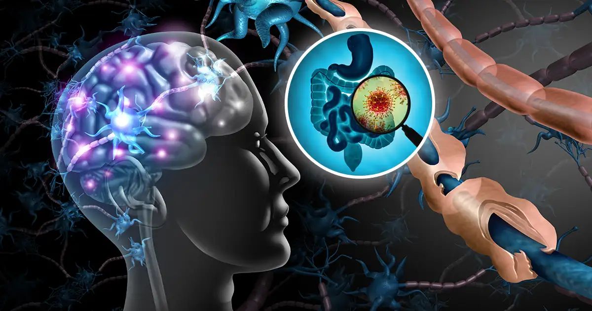 Ungleichgewicht im Darmmikrobiom wird mit Multipler Sklerose in Verbindung gebracht