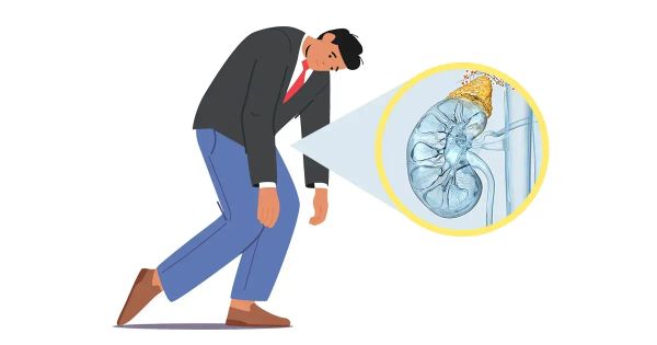 Ständig erschöpft? Mach nicht die Nebennierenschwäche verantwortlich