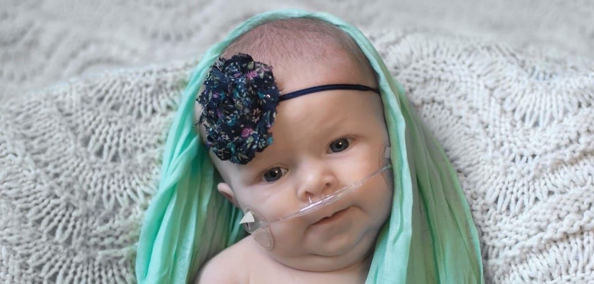 A baby wearing an oxygen cannula, a floral headband, and a soft green scarf.