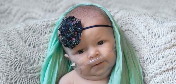 A baby wearing an oxygen cannula, a floral headband, and a soft green scarf.