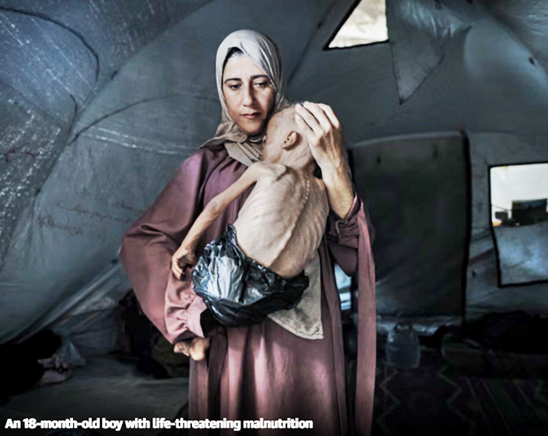 Gaza doctors ‘becoming too weak to treat patients’ as hunger crisis deepens