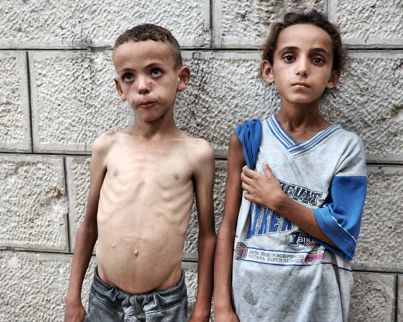 ‘We faced hunger before, but never like this’: skeletal children fill hospital wards as starvation grips Gaza