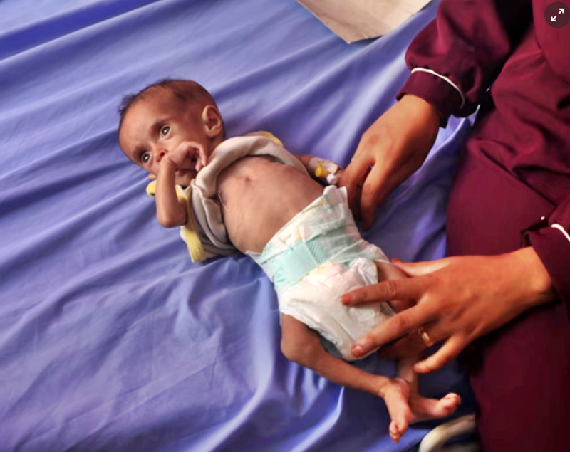 Middle East crisis live: Gaza running out of specialised food to save malnourished children, UN agencies say