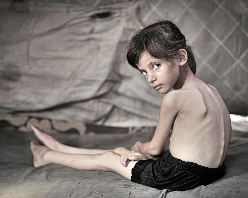 The mathematics of starvation: how Israel caused a famine in Gaza