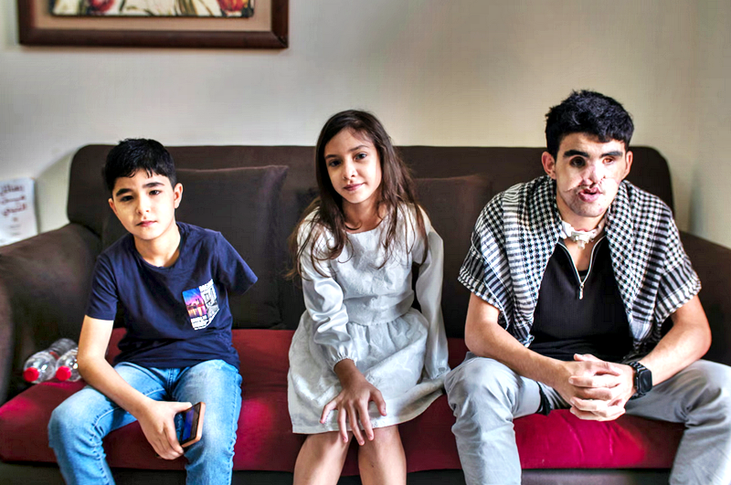 ‘We pray a visa comes before death’: Gaza’s injured children left in limbo