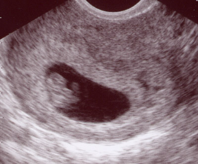 ultrasound1.jpg