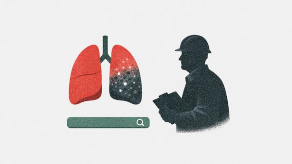 How awareness campaigns are improving early mesothelioma detection