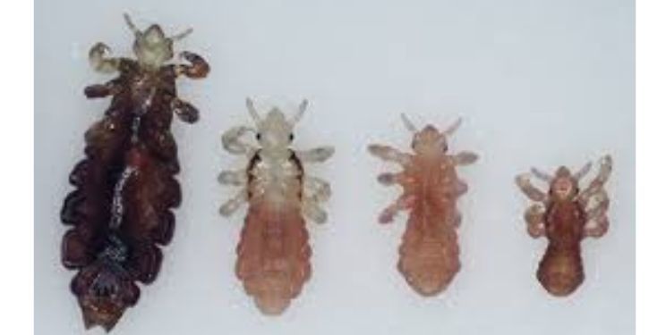 does hair dye kill lice