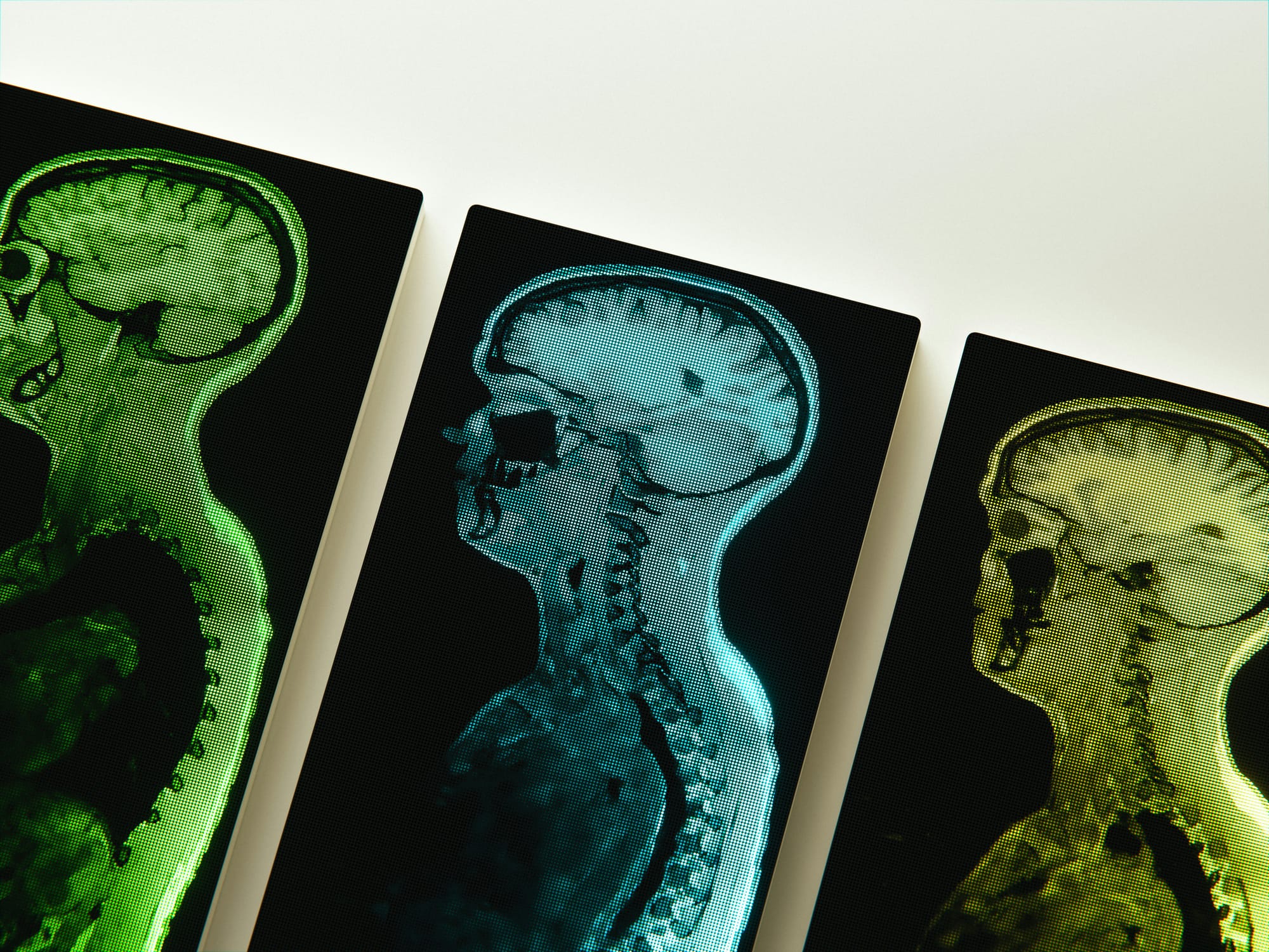 Skills or Mindset? Why Talent Alone Never Wins