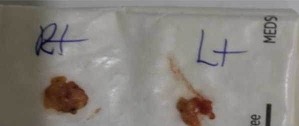 Why a 1 cm Incision Can Be One of the Hardest Surgeries — 7