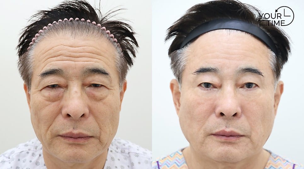 Why a 1 cm Incision Can Be One of the Hardest Surgeries — 8