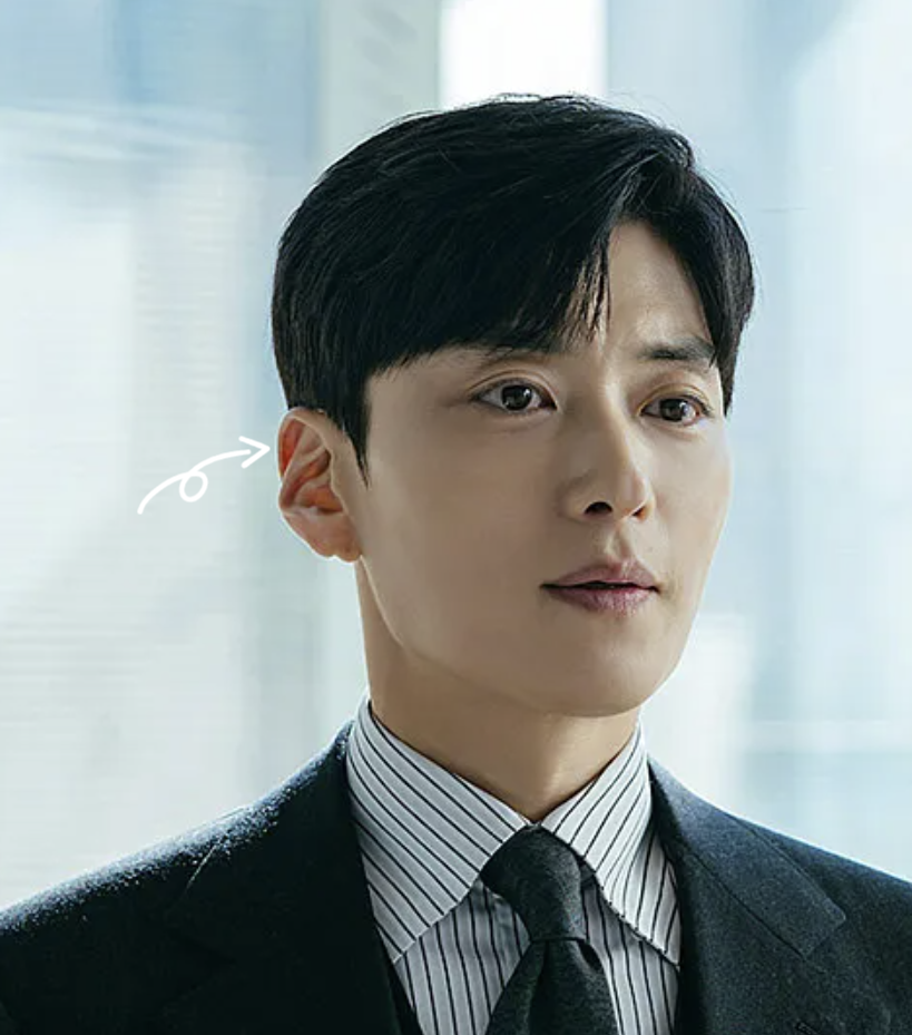Ear Filler for Men: Reshaping Flat or Folded Ears