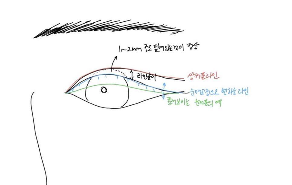 5 Things That Change After a Brow Lift: What to Expect — 18