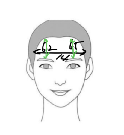 Forehead Reduction Self-Check List: Should You Get the Surgery or Not? — 6