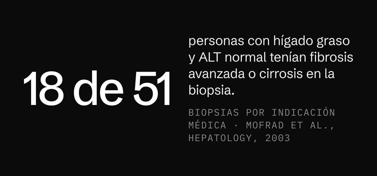 18 de 51 personas con hígado graso y ALT normal tenían fibrosis avanzada o cirrosis en la biopsia
