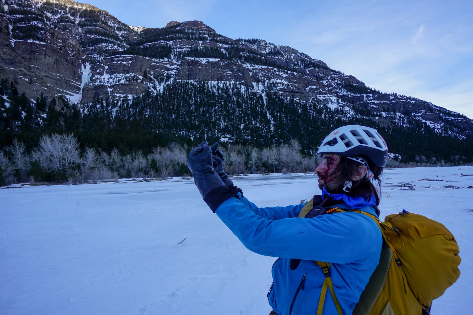 An ice climber with blood on his face flips a double bird to an ice climb in the distance, where he was injured.