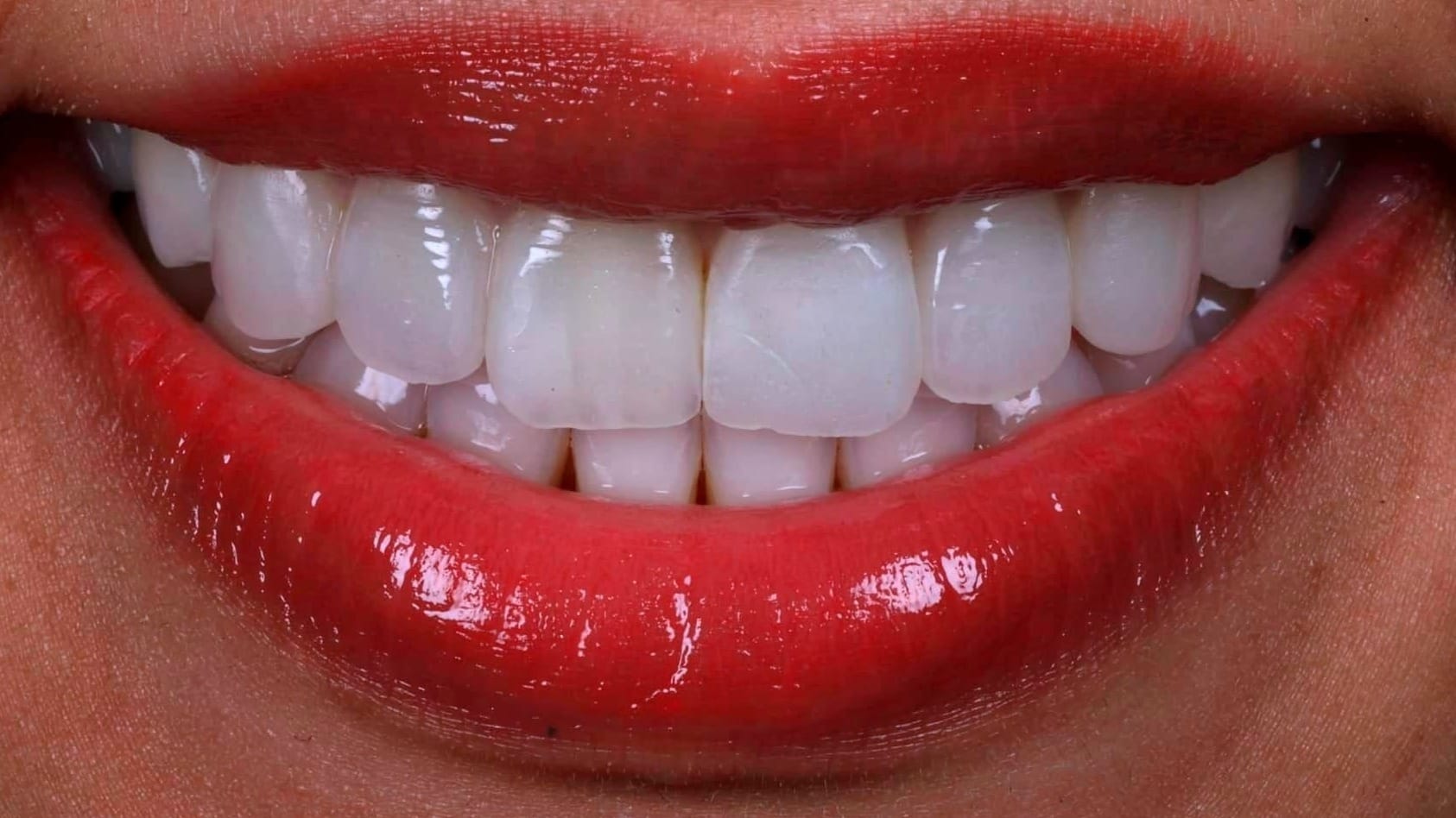 Dentalfotografie Blog für Zahnärzte & Zahntechniker 