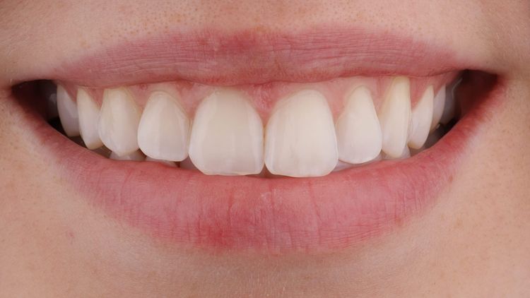 Tipps für strahlende Ergebnisse und perfekte Patientenkommunikation