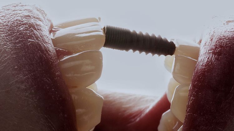 Dentalfotografie: Die besten Tipps für beeindruckende Aufnahmen