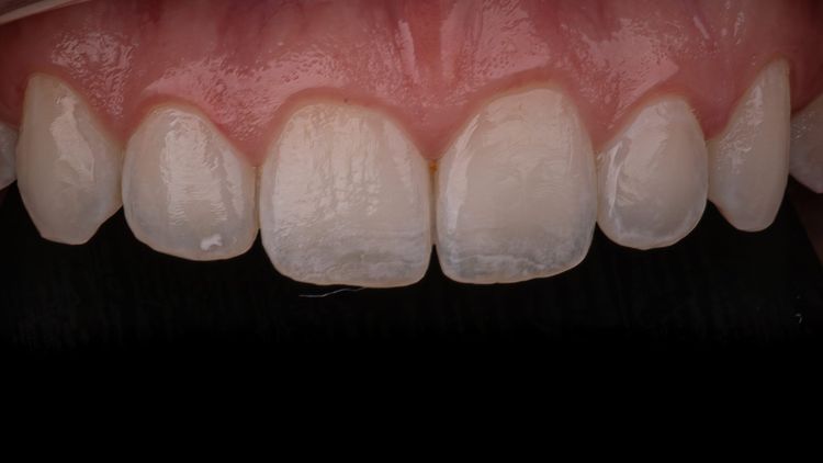 Der ultimative Leitfaden zum 16:9-Format in der Dentalfotografie: Professionelle Kameraeinstellungen für moderne Zahnarztpraxen