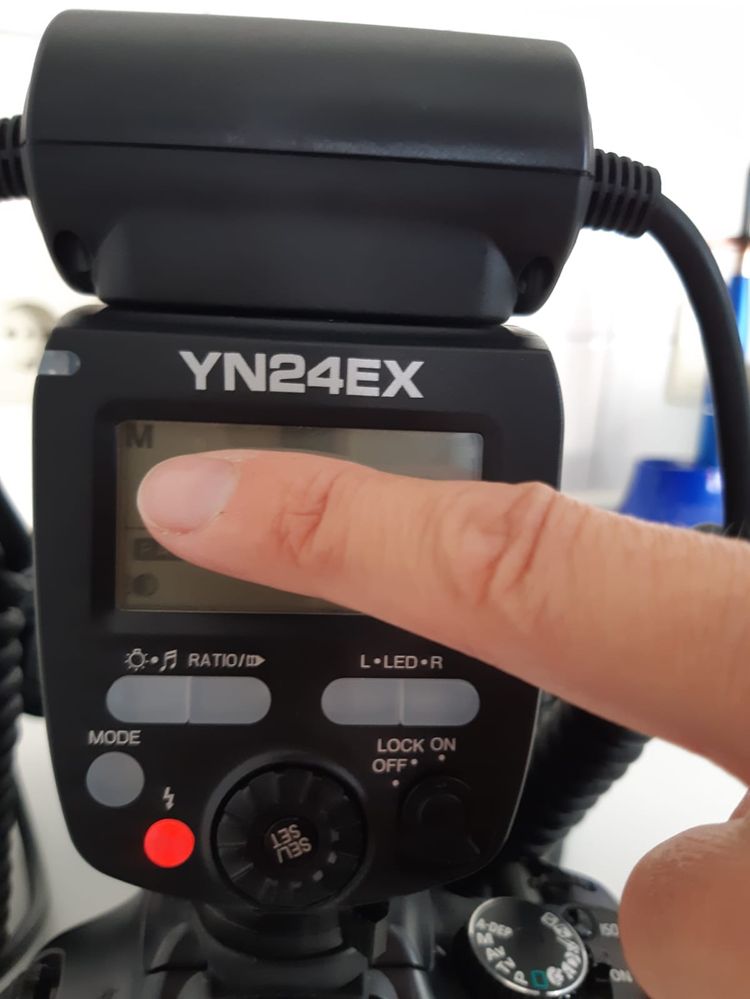 Die mir am meisten gestellteste Frage. Welche Einstellung verwende ich Kirsten in der Dentalfotografie?