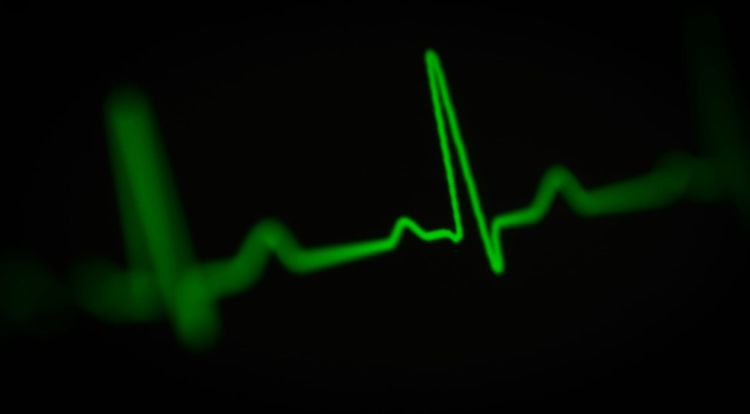 Atrial Fibrillation After 40: The Silent Rhythm Problem Your Heart Check Misses