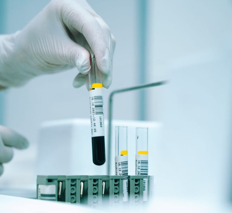 GDF-15: The Stress Biomarker That Predicts Mortality