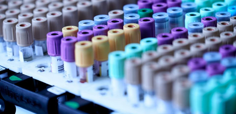 Uric Acid Biomarker: Not Just a Gout Marker