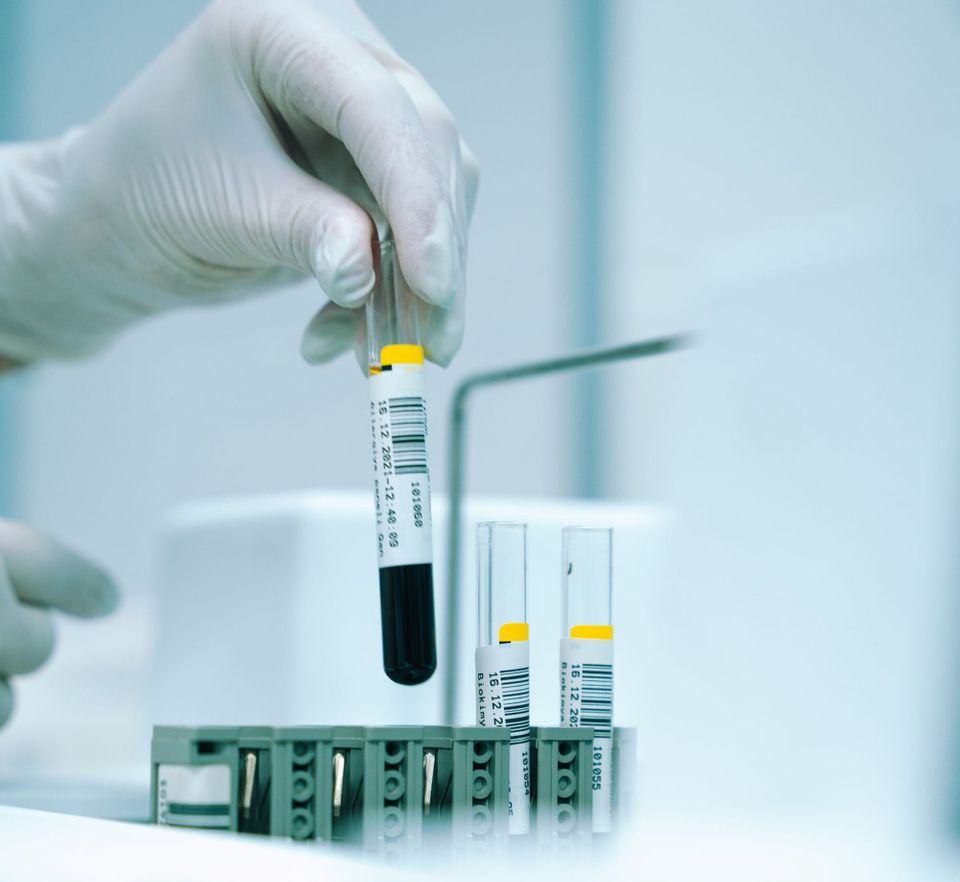 GDF-15: The Stress Biomarker That Predicts Mortality