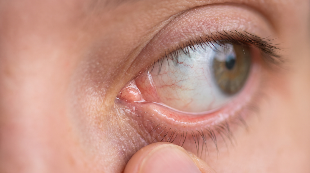 The Fold in the Corner of Your Eye Is a Third Eyelid