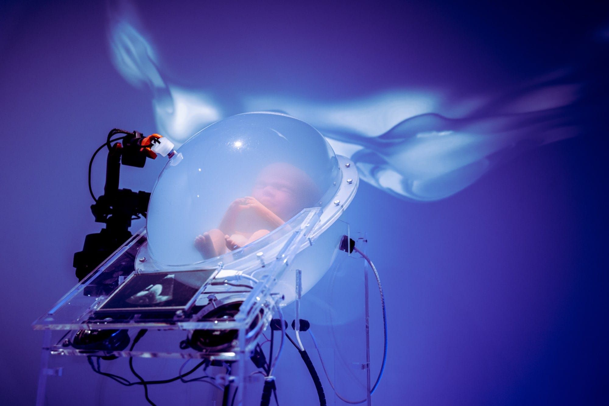 Un neonato in un'incubatrice.