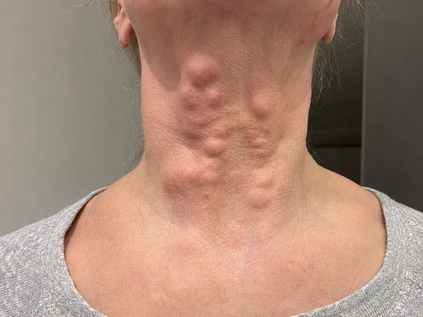 Tous les injectables ne peuvent pas être dissous.