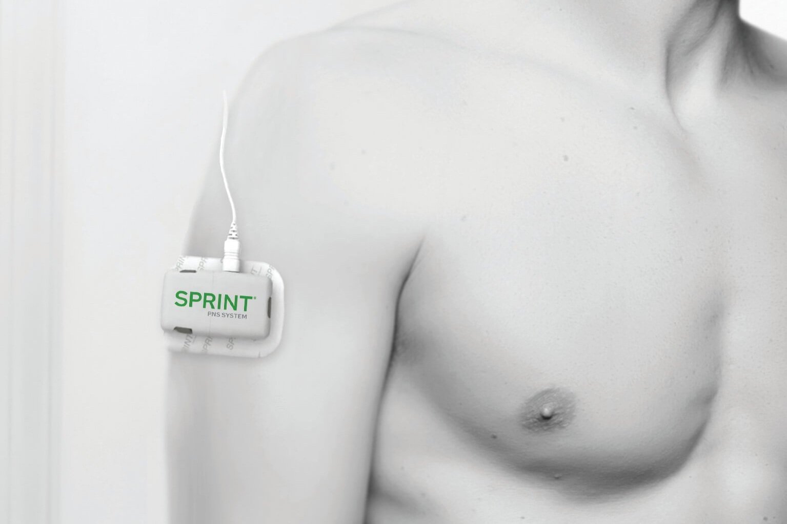   Photo credit: SPR Therapeutics, Inc.  