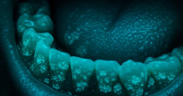 Oral Microbiome Explained: Your Biggest Questions Answered