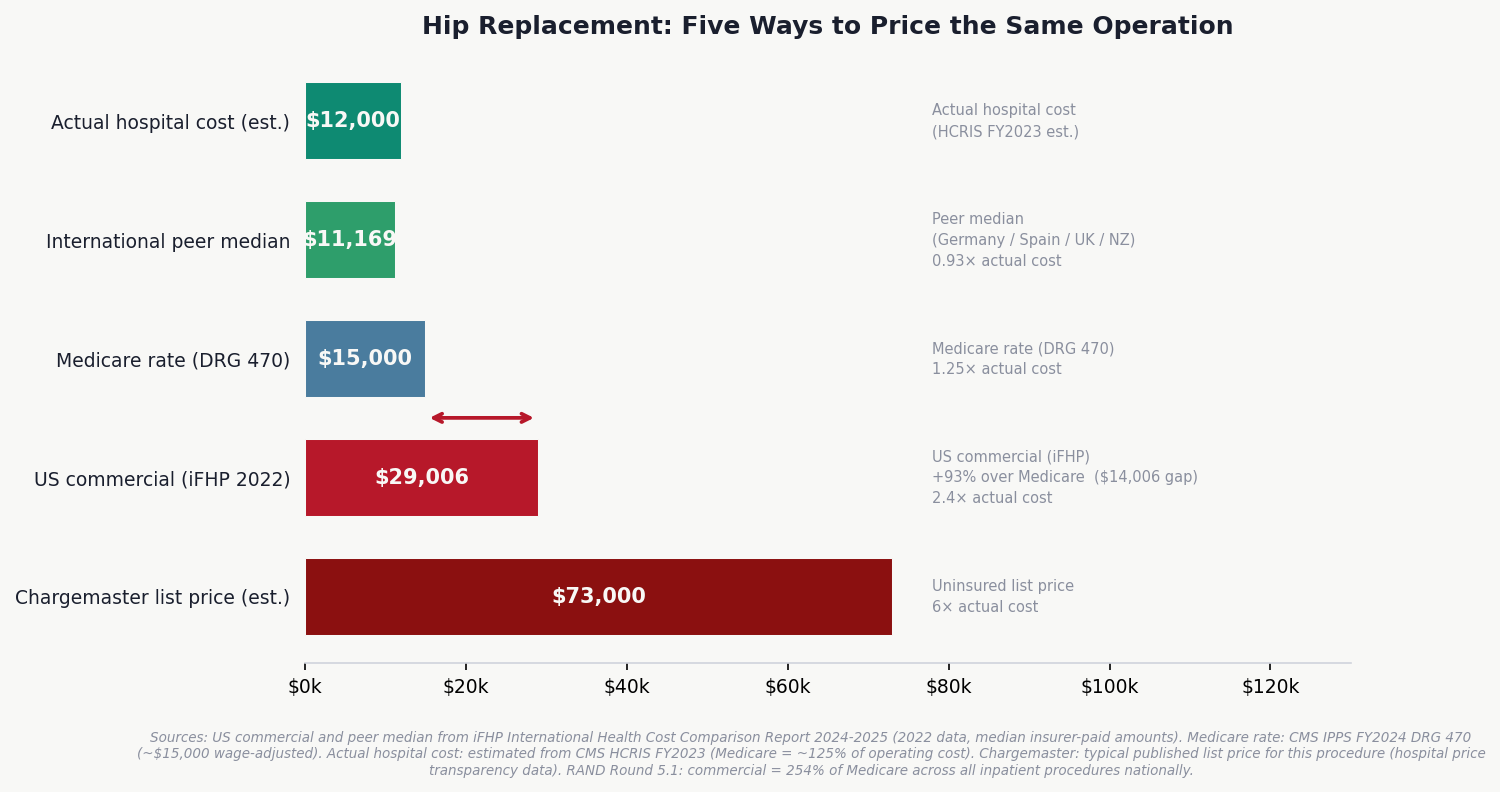 Chart 2: The Price Stack — Hip Replacement