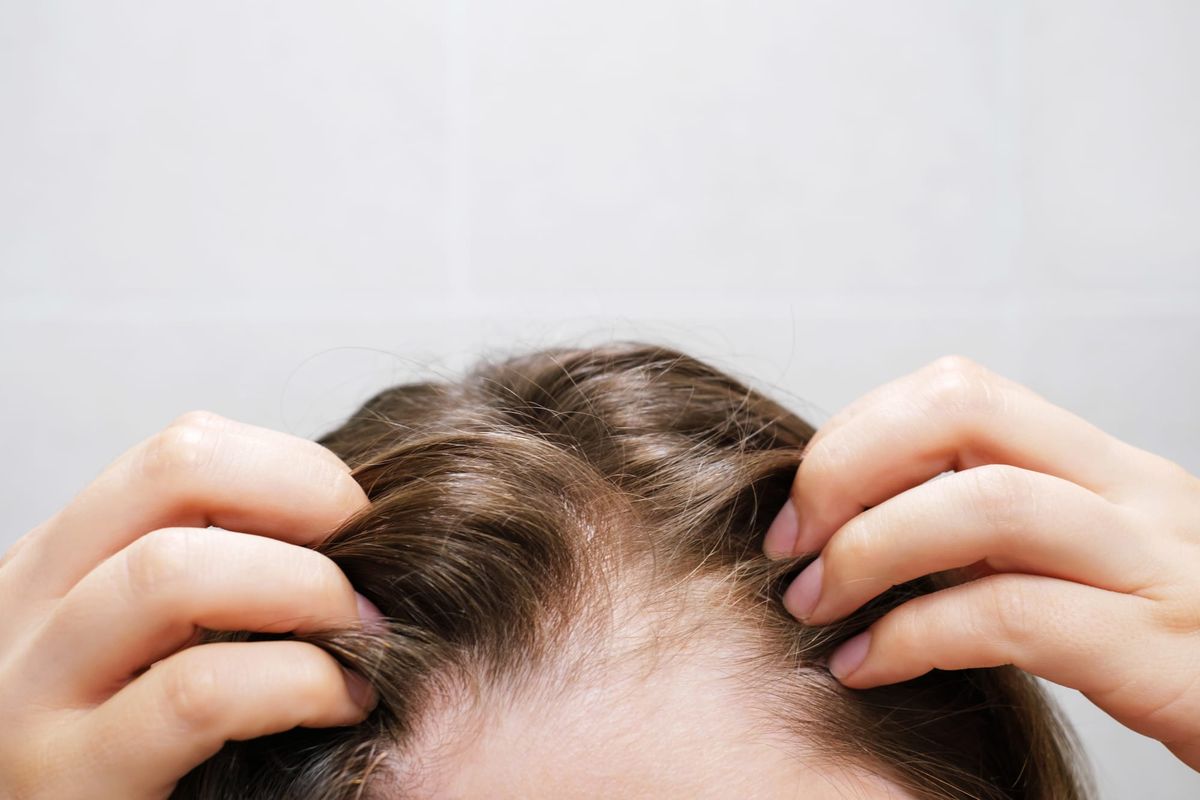 The Glucose Spike: Why Your "Healthy" Breakfast is Thinning Your Hair