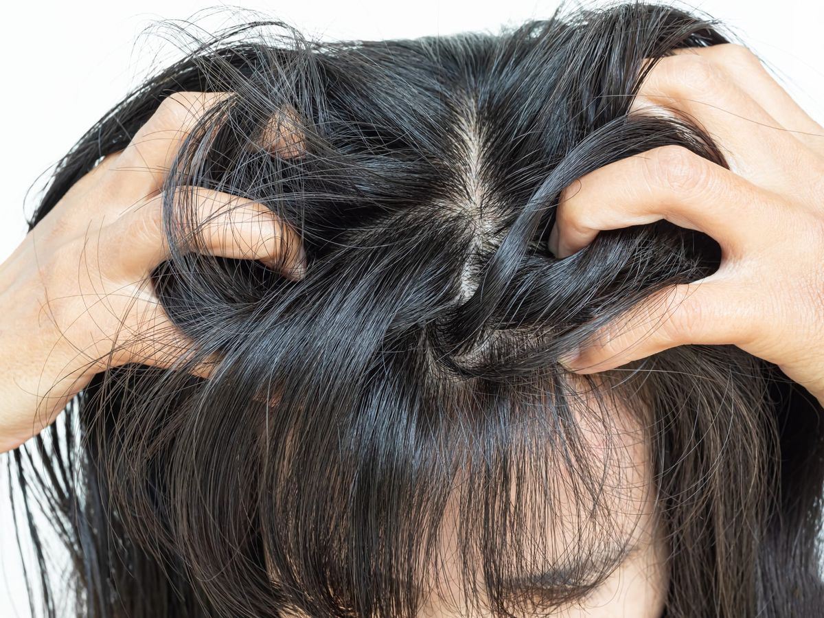 Scalp Glycation: How Your Skin’s "Sugar Crust" is Literally Stifling New Hair Growth