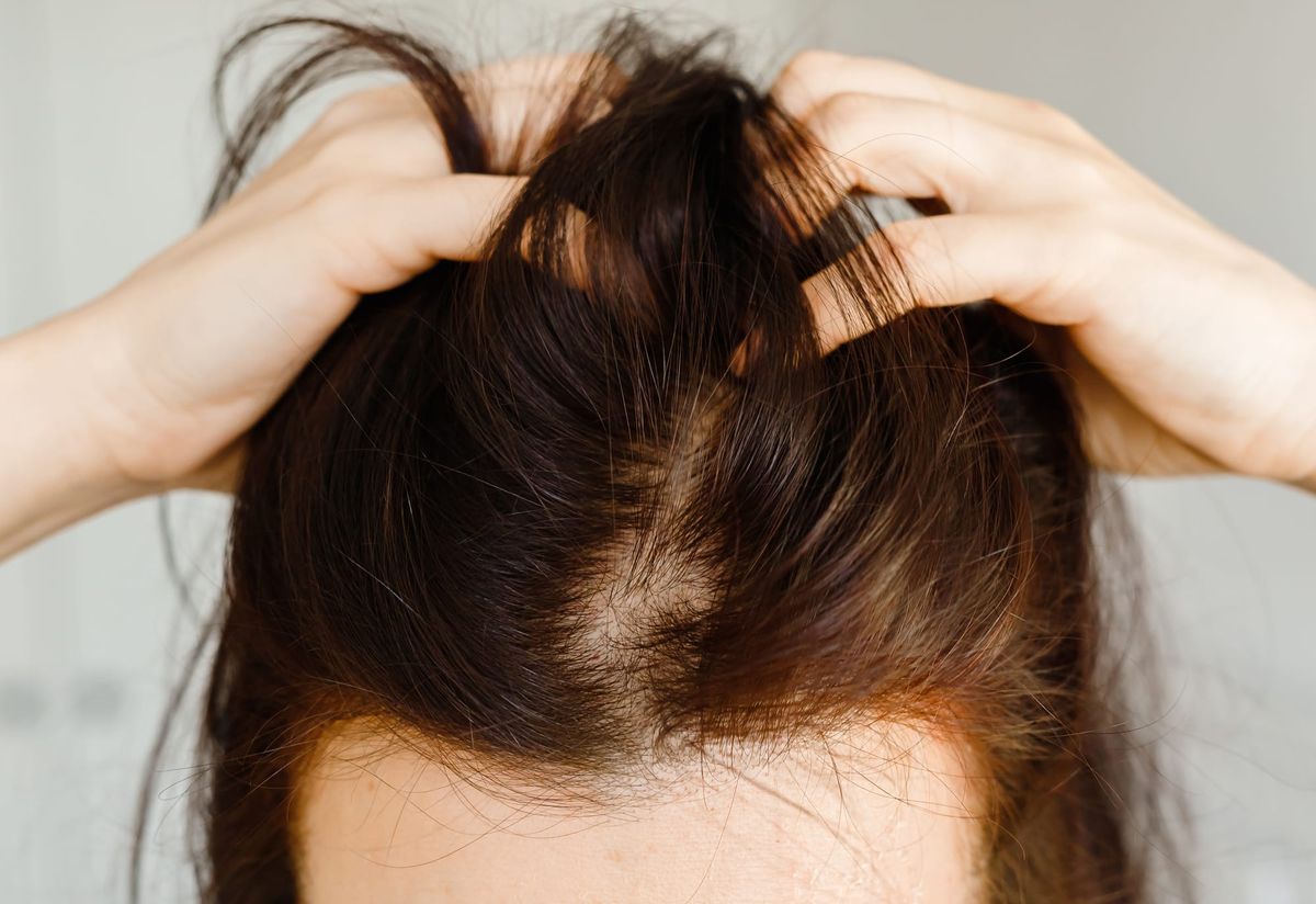 Why a Sore Scalp Means Your Natural Oils Have Turned Harmful