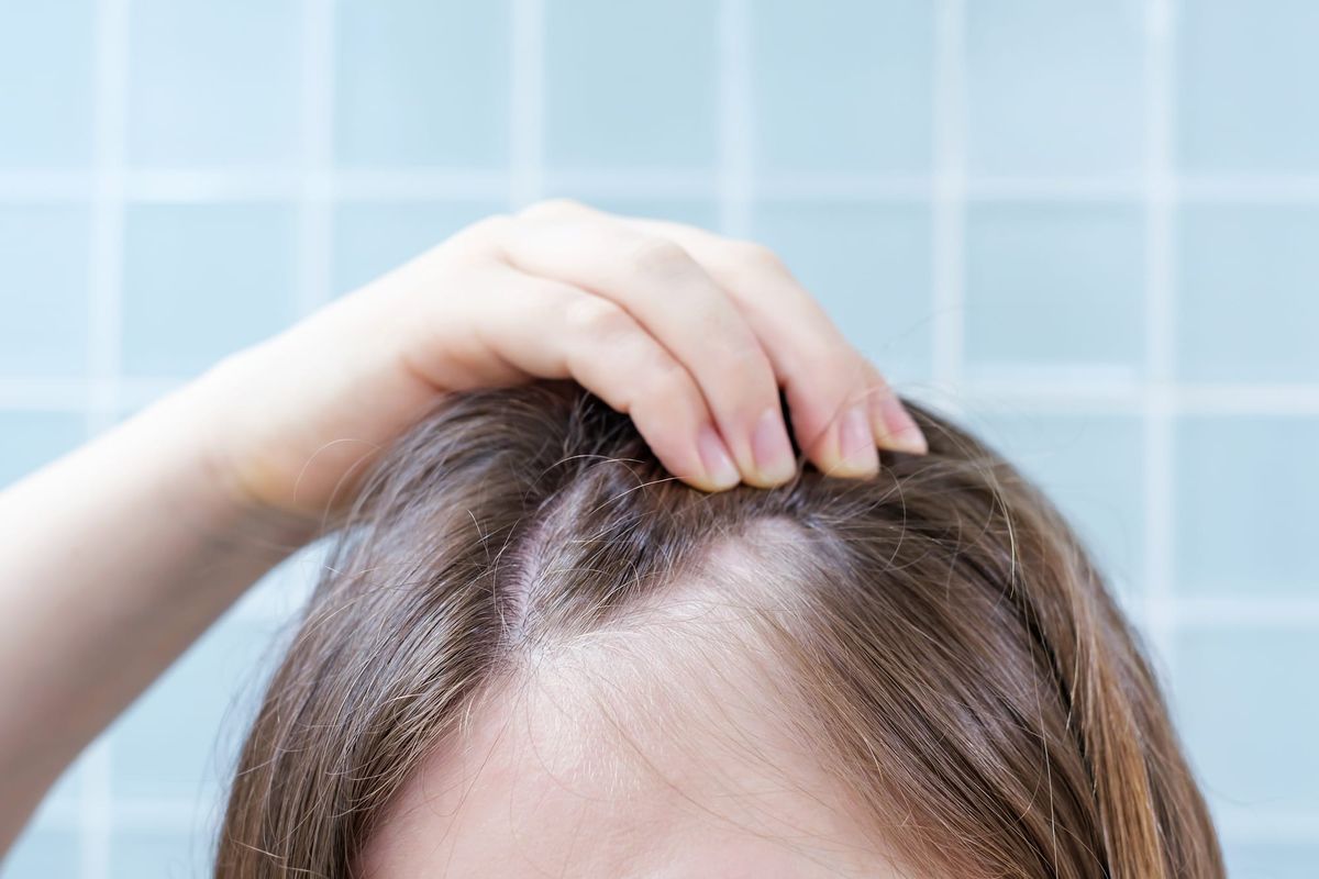 The Oxygen Deficit: How Dormant Follicles Suffocate Beneath Tight Scalp Tissue